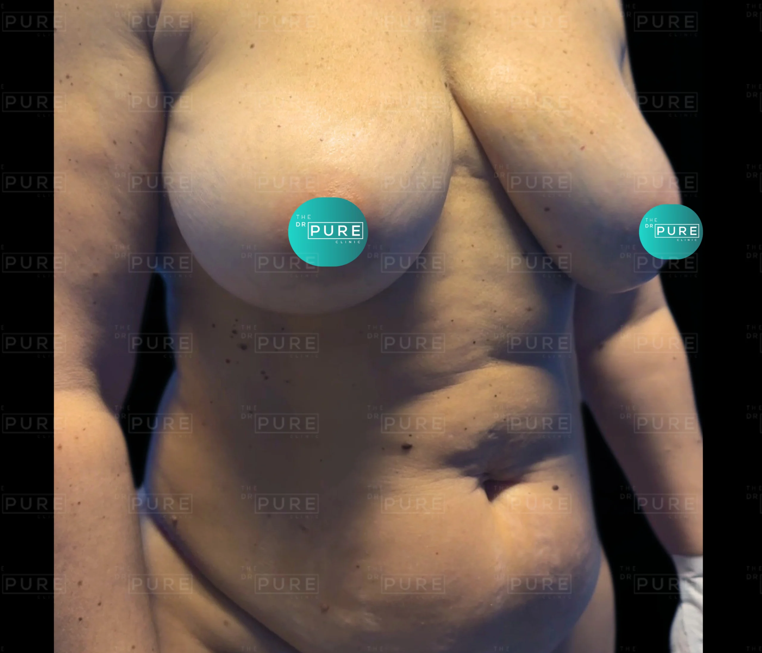 1 1