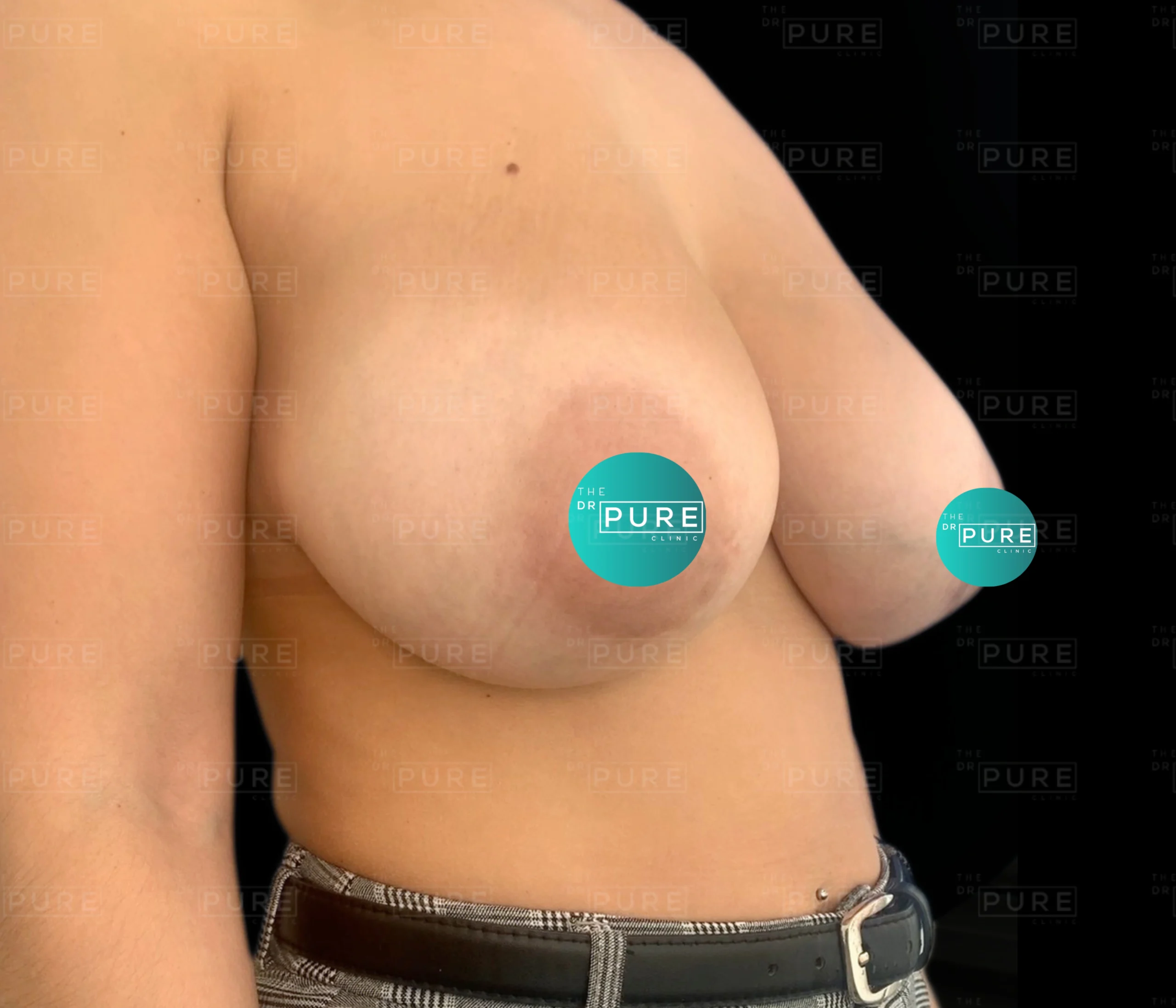 5 5